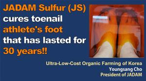 JADAM Sulfur(JS) cures toenail athlete’s foot that has lasted for 30 years!!